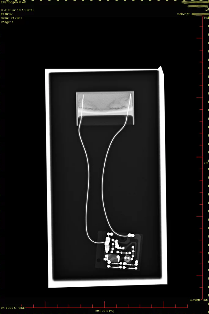 Röntgenbild der scharzen Box in electricity saving unit